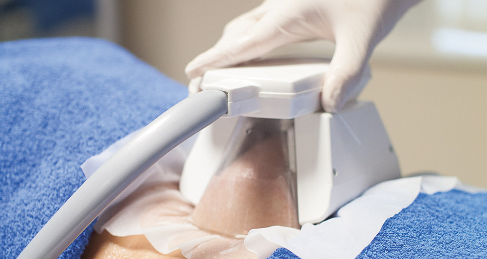 How Fat Freezing and HIFU Work Together? 2 Multiple Areas in One Session HIFU and Fat Freezing Chelmsford