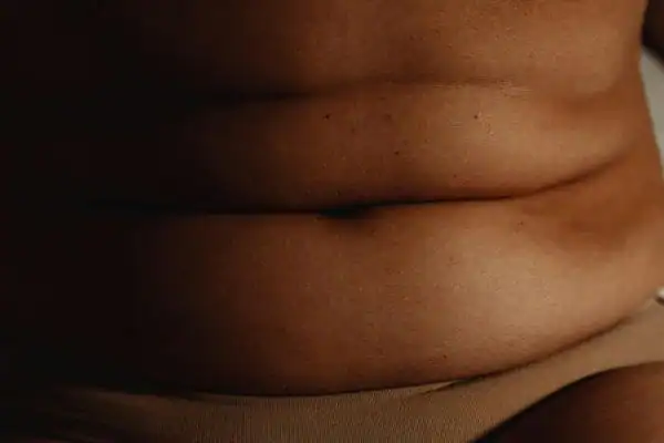 The Hidden Connection: How Stress Shapes Your Fitness and Body Composition 3 image of what stress can do on the stomach area and how Lipo 360 Chelmsford can help to change your body shape.